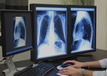 Marcos Tavares propõe piso salarial para técnicos em radiologia