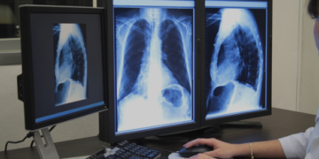 Marcos Tavares propõe piso salarial para técnicos em radiologia