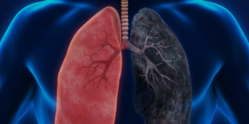 Doença Pulmonar Crônica na pessoa idosa é tema de debate em comissão