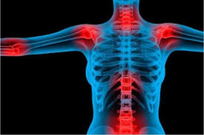 Deputados pedem urgência na apreciação de projetos para priorizar o atendimento da pessoa diagnosticada com fibromialgia